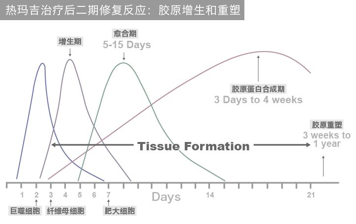 热玛吉反应2-1.jpg